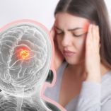 ¿Cuándo el dolor de cabeza puede ser síntoma de tumor cerebral?