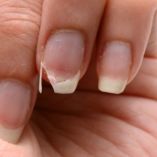 Remedios para reparar uñas dañadas por acrílico