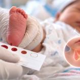 Tamiz neonatal mediante prueba de sangre en un recién nacido para detectar hipotiroidismo congénito