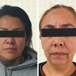 Las detenidas fueron identificadas Sonia “N”, encargada de ofrecer y cobrar el servicio, así como Mariana “N”, quien se desempeñó como anestesióloga