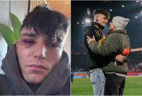 Tras pedir matrimonio a su novio, el árbitro Pascal Kaiser fue atacado en su casa.