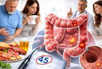 ¿Qué personas son más propensas al cáncer de colon?