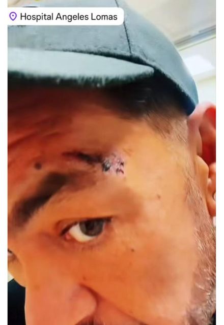 Jorge D'Alessiio habla de la fuerte caída que sufrió en el escenario en Pachuca