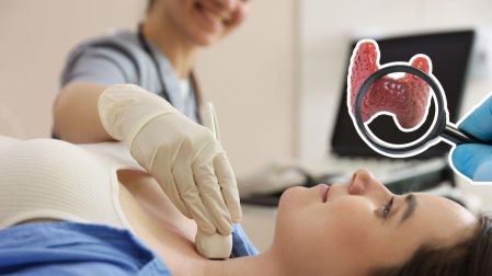 ¿Cuántos kilos puedes aumentar por problemas de tiroides?