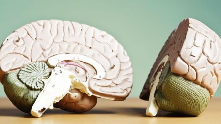 ¿Cuándo el dolor de cabeza puede ser síntoma de tumor cerebral?