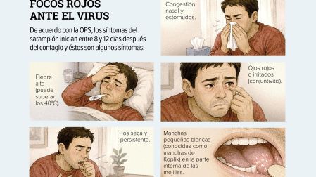 De acuerdo con la OPS, éstos son algunos de los síntomas de la enfermedad.