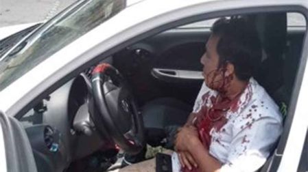 Un chofer de taxi resultó lesionado
