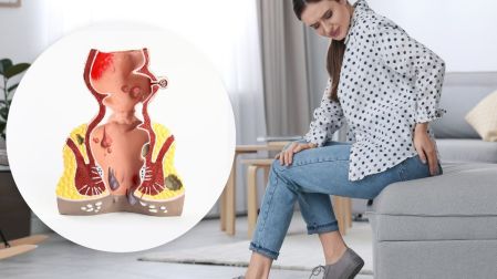 El uso del móvil en el baño incrementa el riesgo de hemorroides. Foto: Canva.