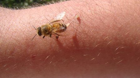 ¿Qué hacer si te pica una abeja?