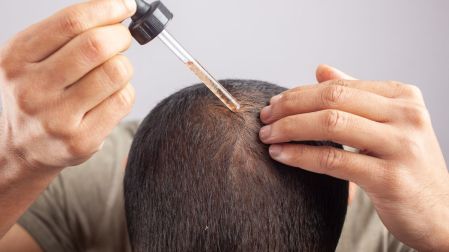 ¿Es seguro usar minoxidil cerca de mascotas?
