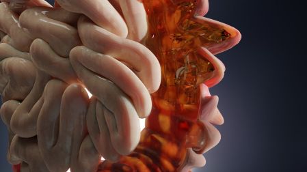 ¿La colitis nerviosa puede convertirse en colitis ulcerosa? Respuestas médicas