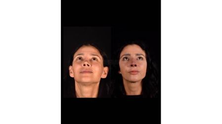 Dorismar se sometió a varios procedimientos reconstructivos.
