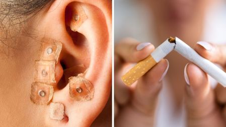 Cómo funciona la auriculoterapia para dejar de fumar
