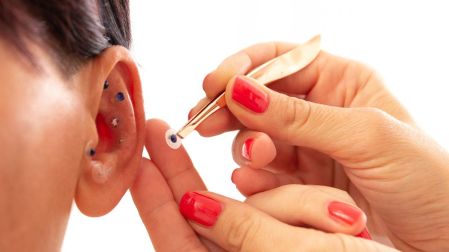 Cómo funciona la auriculoterapia para dejar de fumar