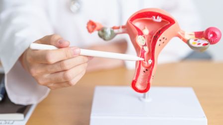 ¿Es difícil embarazarte si tienes endometriosis?