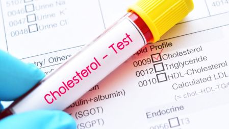 El estrés puede ser responsable de tu colesterol alto; estrategias para bajarlo