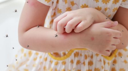 Olores que no debes usar en tu piel si no quieres que te piquen los mosquitos