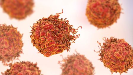 ¿A qué edad se debe hacer la prueba del cáncer de próstata?
