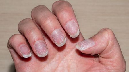 ¿Qué le pasa a tus huesos después de los 30 años?