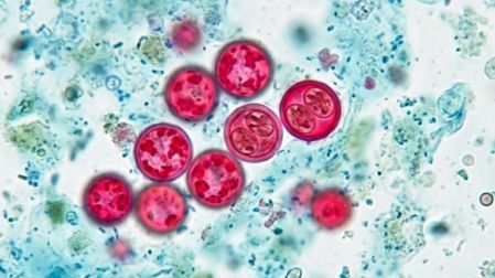 Cyclospora qué es, síntomas además de la diarrea repentina y cómo se transmite