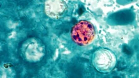 Cyclospora