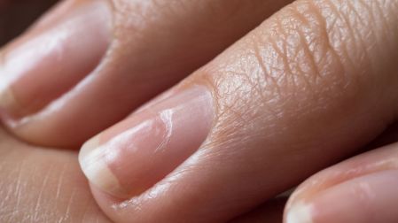 Remedios para reparar uñas dañadas por acrílico