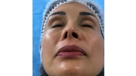 Tanya Vázquez deja Sale el Sol por una cirugía