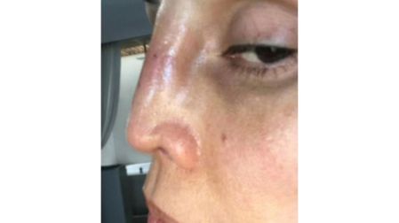 Tanya Vázquez deja Sale el Sol por una cirugía