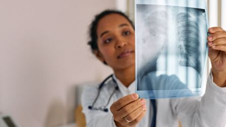 Plantas medicinales para los pulmones: ¿cuáles son y son seguras?