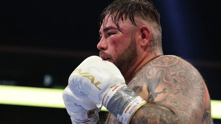 El excampeón mundial de los pesados, Andy Ruiz, terminó con el rostro inflamado
