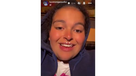 Lucerito Mijares confirma que tuvo apendicitis y revela cómo se encuentra tras la operación