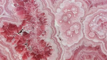¿La fibrosis quística es hereditaria?
