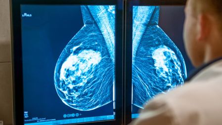 ¿Por qué algunas mujeres tienen que hacerse ultrasonido después de una mastografía?