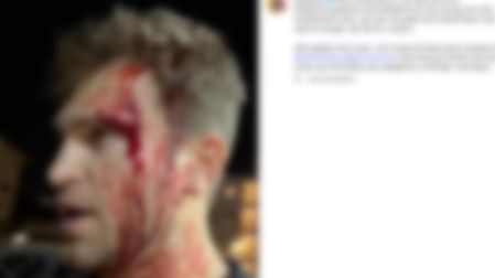 Keegan Allen sufre asalto en calles de Los Ángeles.