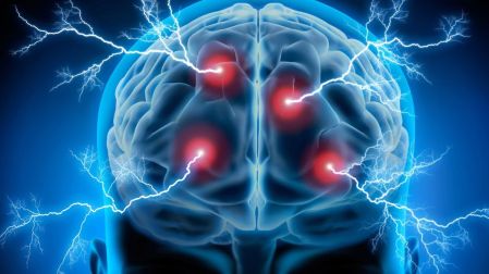 Existe una relación entre el cerebro de los pacientes con obesidad y el de una persona con un trastorno psiquiátrico