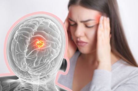 ¿Cuándo el dolor de cabeza puede ser síntoma de tumor cerebral?