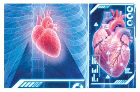 La grasa que rodea al corazón, por ejemplo, está lejos de ser inofensiva: es un tejido que produce sustancias inflamatorias que a su vez endurecen las arterias y terminan por obstruirlas.