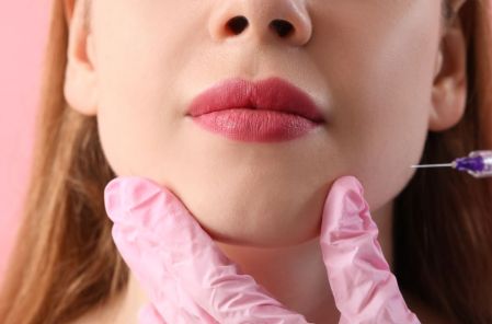Diferencia entre ácido hialurónico y toxina botulínica: ¿a qué edad se deben usar?