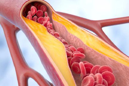 Un medicamento contra el colesterol está en Fase 3