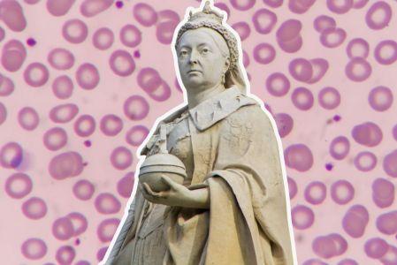 Esta enfermedad genética afectó principalmente a los varones de familias nobles.