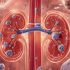 Cálculos renales podrían tener por causa comunidades de bacterias