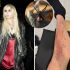 Taylor Momsen hospitalizada: qué hacer ante una picadura de araña venenosa
