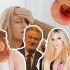 Famosos que padecen la enfermedad de Lyme