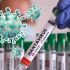 Varias personas fueron aisladas preventivamente tras compartir vuelos con pasajeros expuestos a hantavirus.