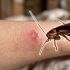 ¿Cómo identificar la mordida de una cucaracha?