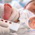 Tamiz neonatal mediante prueba de sangre en un recién nacido para detectar hipotiroidismo congénito