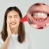 ¿Tus dientes se ven más largos Puede tratarse de recesión gingival