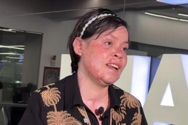 Janeth Guadalupe, de 22 años, sobrevivió a la explosión en La Concordia.