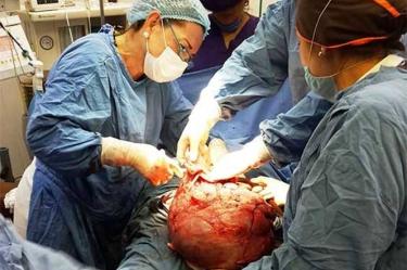  Un grupo de médicos del Hospital Regional de Alta Especialidad de la Mujer en Tabasco extirparon un gigantesco tumor de 9 kilos a una joven mujer 