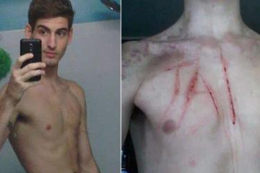 Micheal Squier publicó una foto de su pecho cortado por Jasmine Triveil, quien lo mantuvo como esclavo. FOTO: Facebook